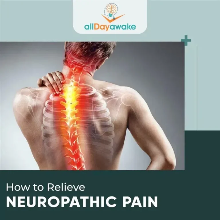 How to Relieve Neuropathic Pain