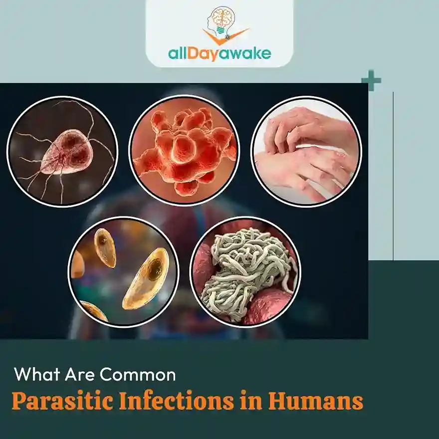 What Are Common Parasitic Infections in Humans